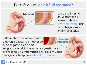 Il Kefir d'acqua: la soluzione ideale per una buona flora intestinale  “pensata” per chi è intollerante ai latticini